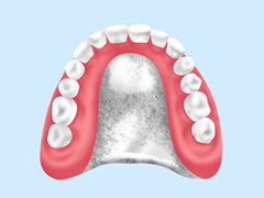 金属床義歯（チタン合金）